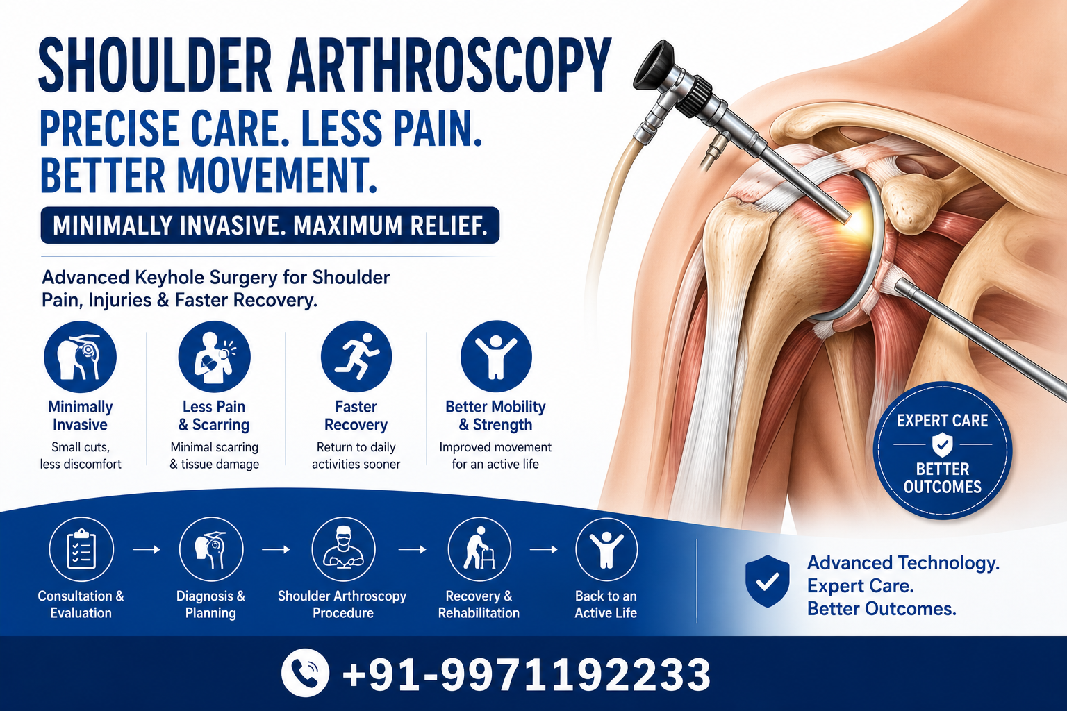 Shoulder Arthroscopy: Complete Guide to Surgery, Recovery, Benefits, Risks and Cost